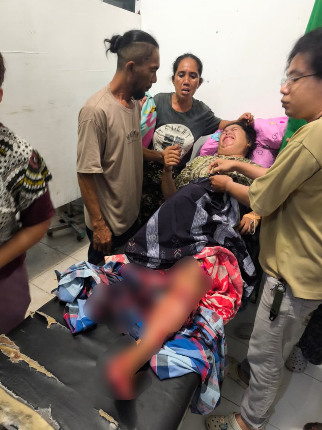 Nampak Warga Desa Iyok, Kecamatan Nuangan, Kabupaten Bolaang Mongondow Timur, Adalah Korban Gigitan Seekor Buaya Saat Berada di Puskesmas.( Foto: Dok)